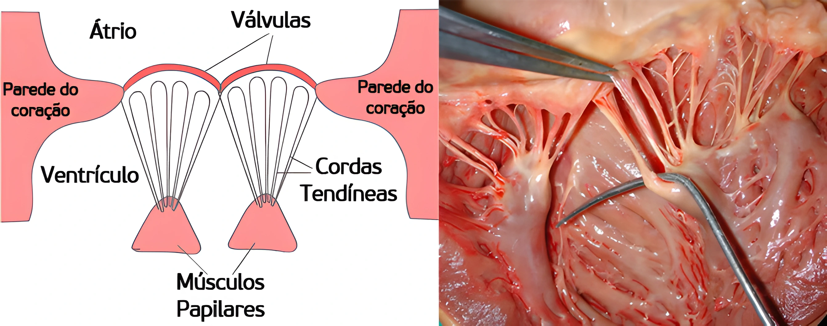 Anatomia Cardíaca