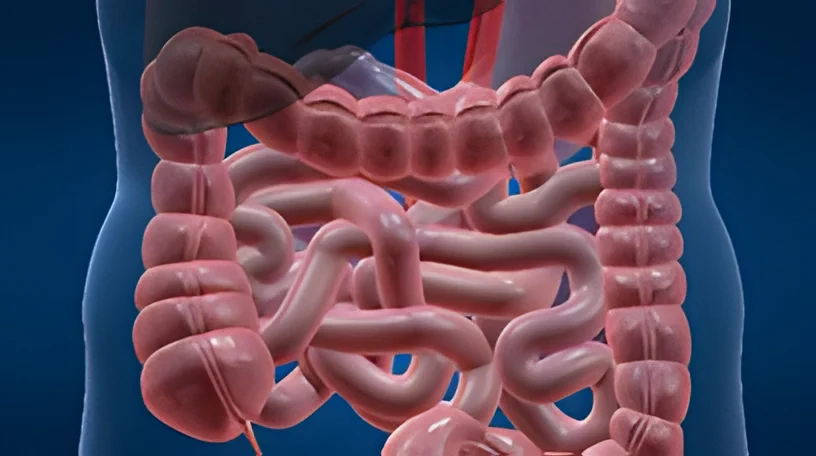 Anemia Ferropriva