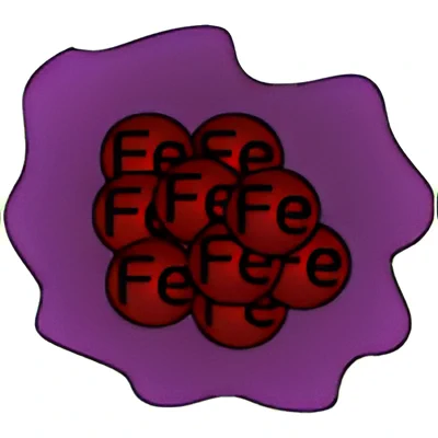 Anemia Ferropriva