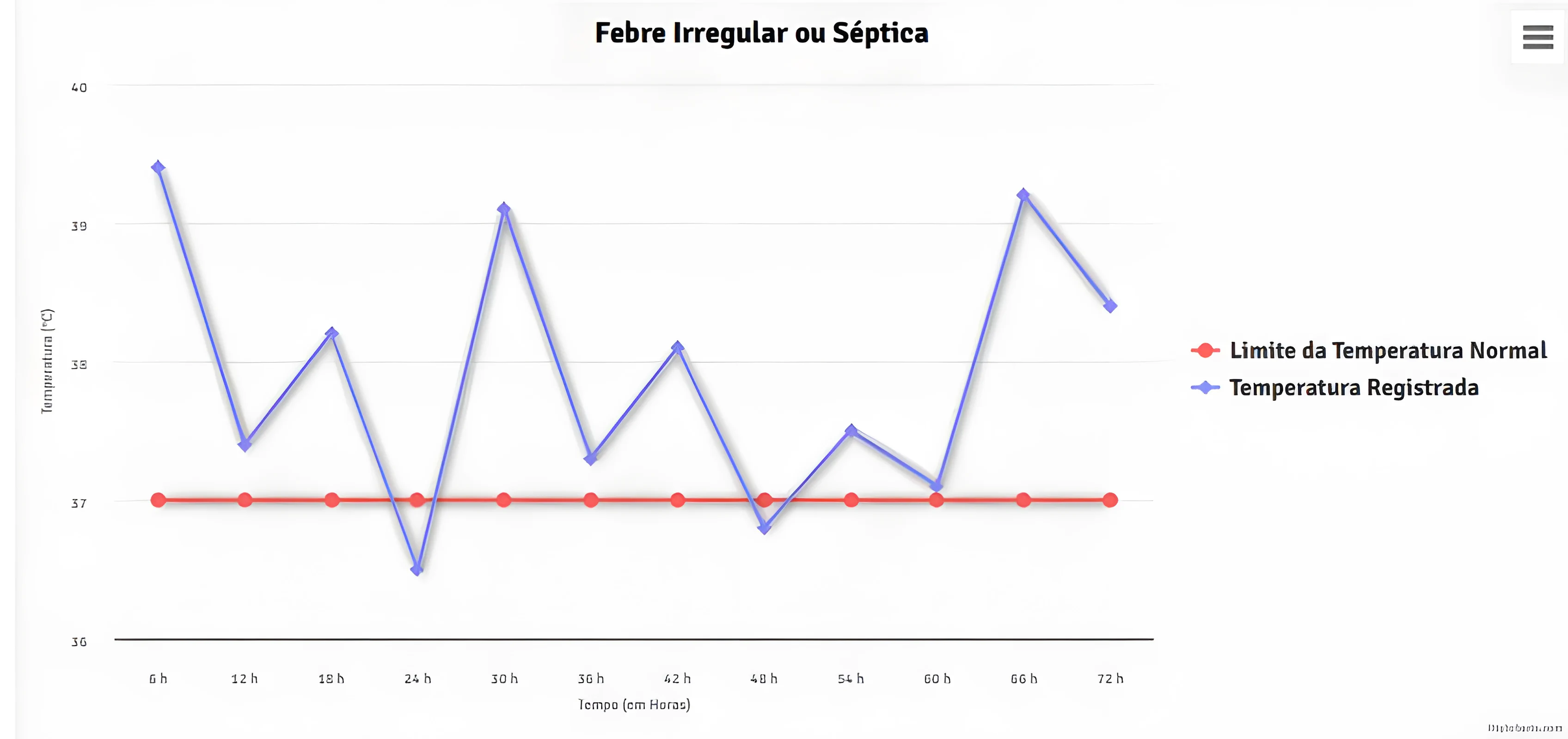 Gráfico de febre irregular ou séptica
